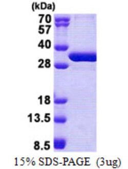 Novus Biologicals&trade;&nbsp;Recombinant Human NSMCE1 His Protein