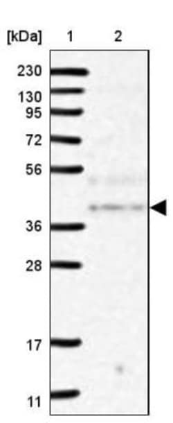 NSMCE4A Antibody, Novus Biologicals:Antibodies:Primary Antibodies