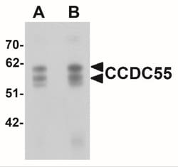 NSRP1 Antibody - BSA Free, Novus Biologicals 0.1mg; Unlabeled:Antibodies,