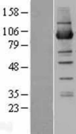Novus Biologicals&trade;&nbsp;NSUN2 Overexpression Lysate