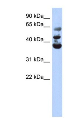 NSUN3 Antibody, Novus Biologicals 100&mu;L; Unlabeled:Antibodies, Polyclonal