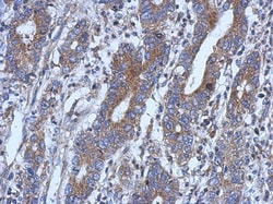 NSUN4 Antibody, Novus Biologicals 0.1mL; Unlabeled:Antibodies, Polyclonal