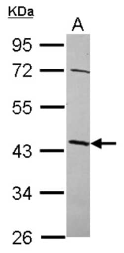 NSUN4 Antibody, Novus Biologicals 0.1mL; Unlabeled:Antibodies, Polyclonal