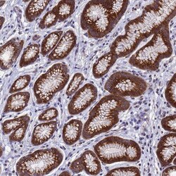 NSUN6 Antibody, Novus Biologicals 0.1 mL | Buy Online | Novus Biologicals | Fisher Scientific