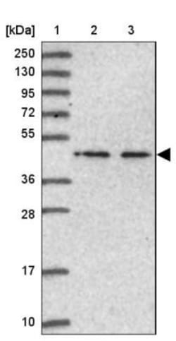 NSUN6 Antibody, Novus Biologicals 0.1 mL | Buy Online | Novus Biologicals | Fisher Scientific