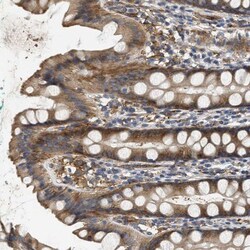 NSUN7 Antibody, Novus Biologicals 25 &mu;L, Unlabeled:Antibodies, Polyclonal