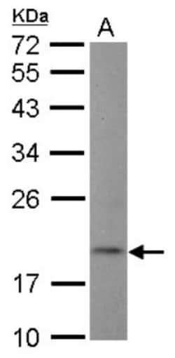 NT5C Antibody, Novus Biologicals 0.1mL; Unlabeled:Antibodies, Polyclonal