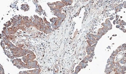 NT5C2 Antibody, Novus Biologicals 0.1mg; Unlabeled:Antibodies, Polyclonal