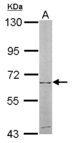 NT5C2 Antibody, Novus Biologicals 0.1mg; Unlabeled:Antibodies, Polyclonal