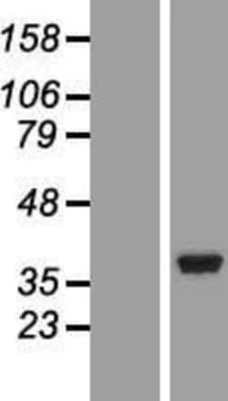 Novus Biologicals&trade;&nbsp;NT5C3 Overexpression Lysate