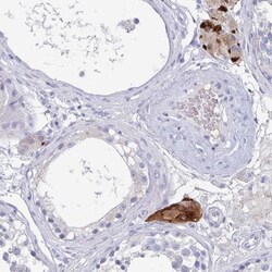 NT5C3L Antibody, Novus Biologicals:Antibodies:Primary Antibodies