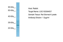 V alpha 24 J alpha 18 TCR Antibody (6B11) - BSA Free, Novus Biologicals