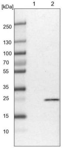 NT5C Antibody, Novus Biologicals 0.1mL; Unlabeled:Antibodies, Polyclonal