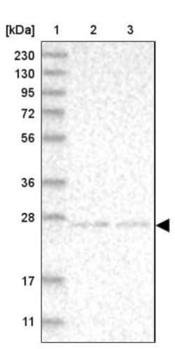NT5C Antibody, Novus Biologicals 0.1mL; Unlabeled:Antibodies, Polyclonal