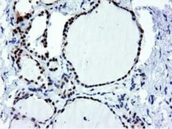NT5DC1 Antibody (OTI1E11), Novus Biologicals 0.1mL; Unlabeled:Antibodies,