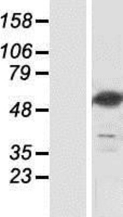 Novus Biologicals&trade;&nbsp;NT5DC3 Overexpression Lysate
