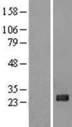 Novus Biologicals&trade;&nbsp;NT5M Overexpression Lysate