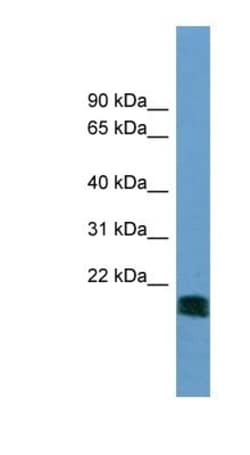 NT5M Antibody, Novus Biologicals:Antibodies:Primary Antibodies