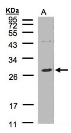 NTAL Antibody, Novus Biologicals 0.1mL; Unlabeled:Antibodies, Polyclonal