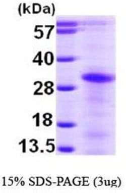 Novus Biologicals&trade;&nbsp;Recombinant Human NTAL His Protein