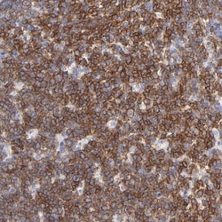 NTAL Antibody, Novus Biologicals 0.1mL; Unlabeled:Antibodies, Polyclonal