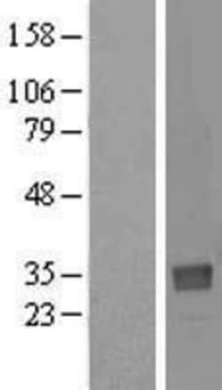 Novus Biologicals™ NTAN1 Overexpression Lysate
