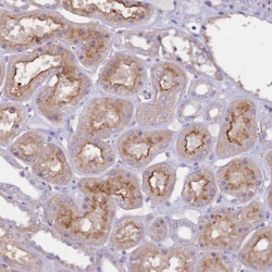 Netrin-4 Antibody, Novus Biologicals 0.1mL; Unlabeled:Antibodies, Polyclonal
