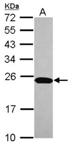 NTPCR Antibody, Novus Biologicals 0.1 mL | Buy Online | Novus Biologicals | Fisher Scientific