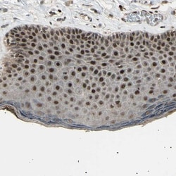 NUAK2 Antibody, Novus Biologicals 25 &mu;L | Buy Online | Novus Biologicals | Fisher Scientific