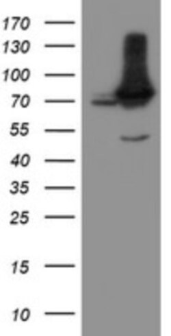 NUB1/NYREN18 Antibody (OTI2G1), Novus Biologicals 0.1mL; Unlabeled:Antibodies,