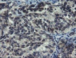 NUB1/NYREN18 Antibody (OTI2G1), Novus Biologicals 0.1mL; Unlabeled:Antibodies,