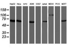 NUB1/NYREN18 Antibody (OTI2G1), Novus Biologicals 0.1mL; Unlabeled:Antibodies,