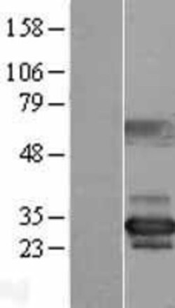 Novus Biologicals&trade;&nbsp;NUBP2 Overexpression Lysate