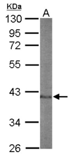 Nuclear Factor Erythroid Derived 2 Antibody, Novus Biologicals 0.1mL; Unlabeled:Antibodies,