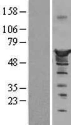 Novus Biologicals™ Nucleobindin 1 Overexpression Lysate