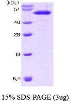 Novus Biologicals&trade;&nbsp;Recombinant Mouse Nesfatin-1/Nucleobindin-2 His Protein