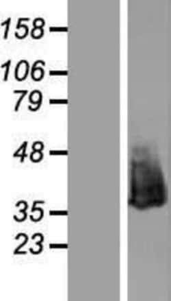 Novus Biologicals&trade;&nbsp;NPM1 Overexpression Lysate