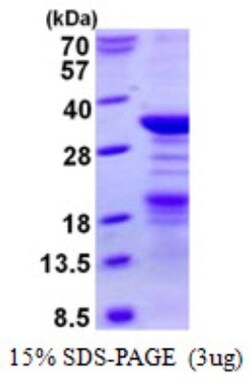 Novus Biologicals&trade;&nbsp;Recombinant Human Nucleoplasmin-2 His Protein