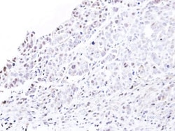 NUP62 Antibody, Novus Biologicals 0.1mg; Unlabeled:Antibodies, Polyclonal