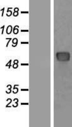 Novus Biologicals&trade;&nbsp;NUP62 Overexpression Lysate