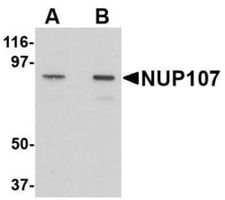 Nucleoporin 107 Antibody - BSA Free, Novus Biologicals 0.1mg; Unlabeled:Antibodies,