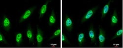 NUP62 Antibody, Novus Biologicals 0.1mg; Unlabeled:Antibodies, Polyclonal
