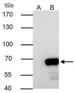 NUP62 Antibody, Novus Biologicals 0.1mg; Unlabeled:Antibodies, Polyclonal