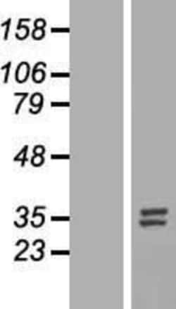 Novus Biologicals&trade;&nbsp;Nucleotide binding protein like Overexpression Lysate