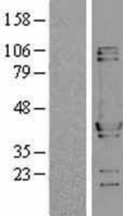 Novus Biologicals™ NUDC Overexpression Lysate