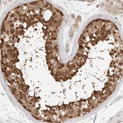 NUDC Antibody, Novus Biologicals 25 &mu;L | Buy Online | Novus Biologicals | Fisher Scientific