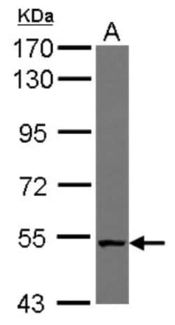 NUDCD1 Antibody, Novus Biologicals 0.1mL; Unlabeled:Antibodies, Polyclonal
