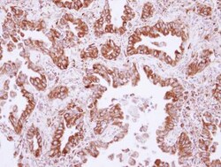 NUDCD1 Antibody, Novus Biologicals 0.1mL; Unlabeled:Antibodies, Polyclonal