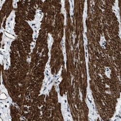 NUDCD3 Antibody, Novus Biologicals 0.1mL; Unlabeled:Antibodies, Polyclonal