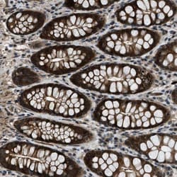 NUDCD3 Antibody, Novus Biologicals:Antibodies:Primary Antibodies